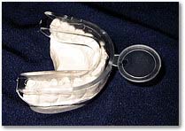 teeth bleaching tray teeth bleaching tray
